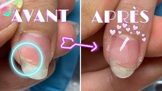 TUTO NAILS ⎥ Comment réparer un ongle fissuré ⛑ [upl. by Cartwright]