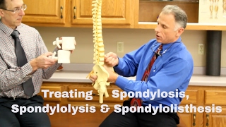 Treating Spondylosis Spondylolysis amp Spondylolisthesis Lumbar Spine [upl. by Ireva279]