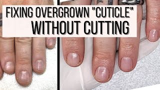 How to FIX Overgrown Cuticles WITHOUT CUTTING [upl. by Avek]