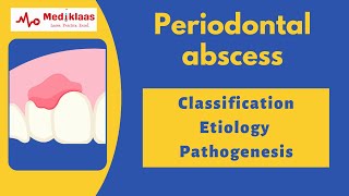 Periodontal Abscess Part 1  Classification etiology pathogenesis microbiology l Mediklaas [upl. by Standford]