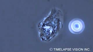 Bacterial phagocytosis by neutrophils [upl. by Nnayelhsa]