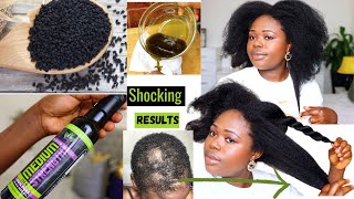 4 Ways to Use Pure Black Seed Oil For Massive hair Growth and For over all Health [upl. by Perseus]