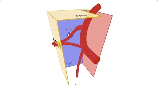 Pterygopalatine Fossa  Anatomy Contents and Borders [upl. by Perseus]