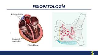 Fibrilación auricular Diagnóstico y tratamiento [upl. by Dijam]